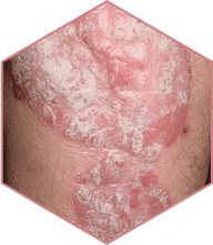 Yenki Derm Produktbild 4