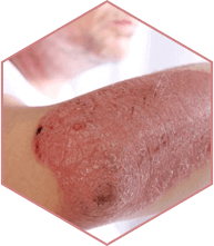 Yenki Derm Produktbild 3
