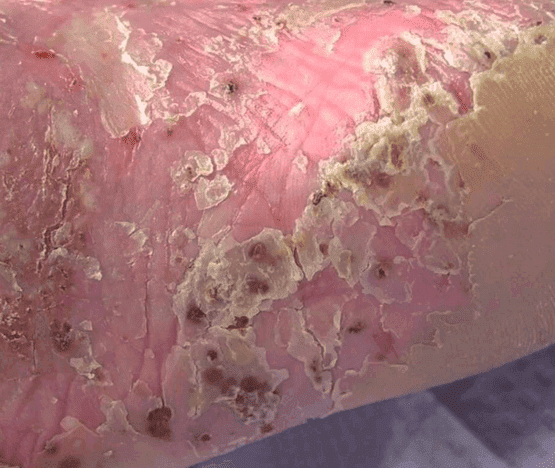 Yenki Derm Produktbild 6