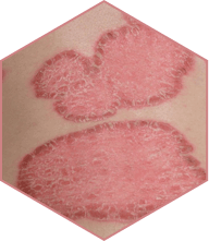 Yenki Derm Produktbild 2